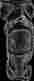 1621-1 Alpinestars Alpinestarts Fluid Tech Carbon Knee Brace Right Ce-certified Ce K Type B